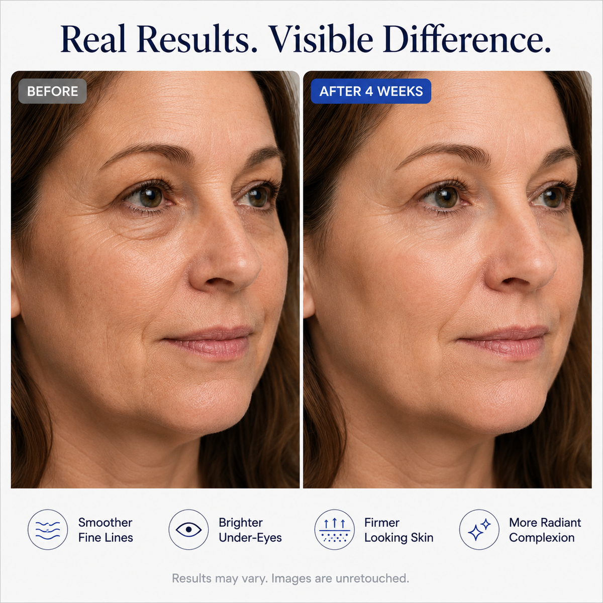 Tevia Micro-Infusion Targeted Patches