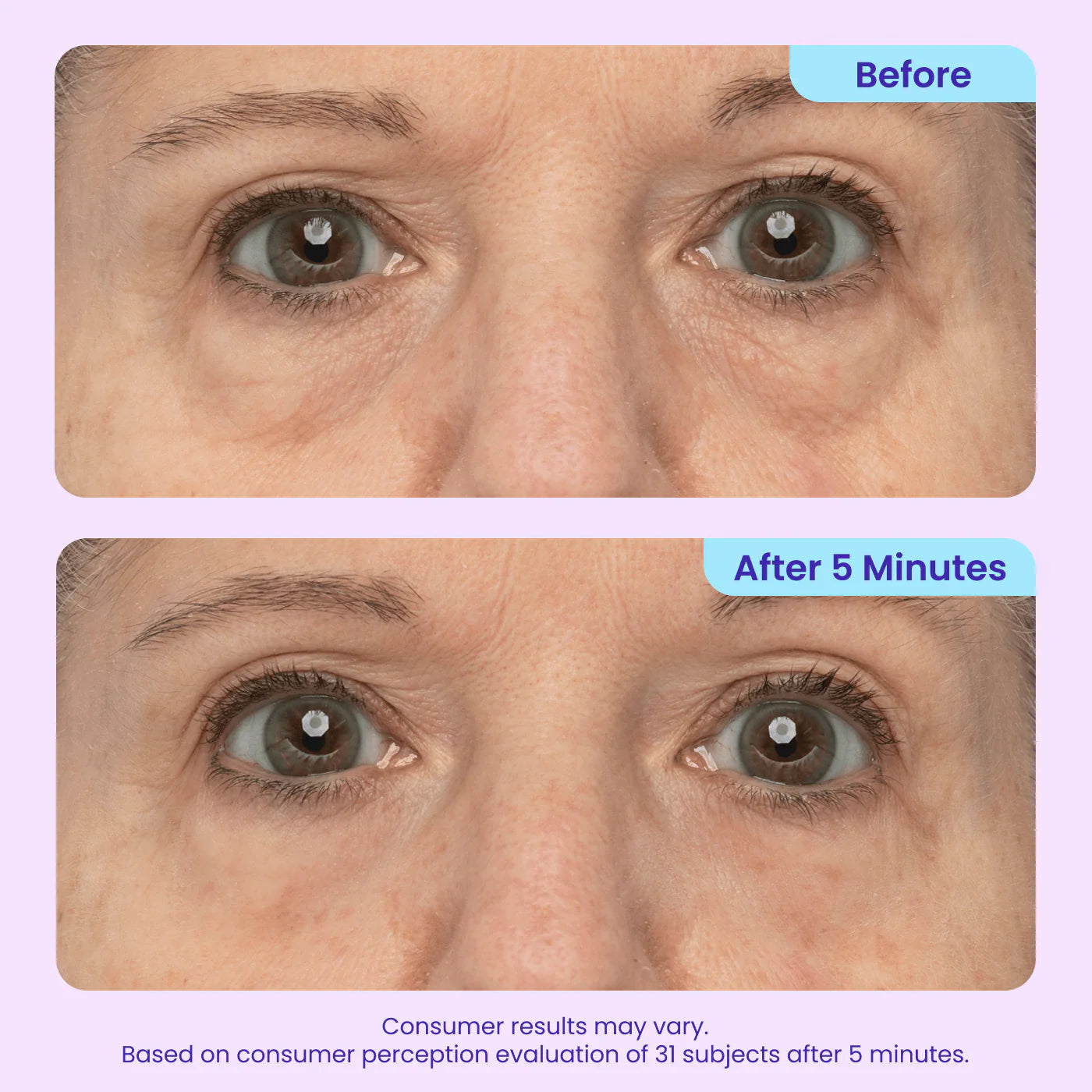 Tevia Instant Lift Eye Gel